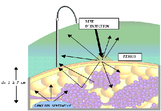 Schema